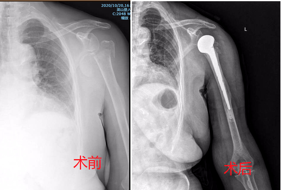 午夜精品白在线观看
