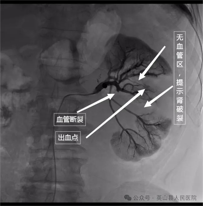 午夜精品白在线观看