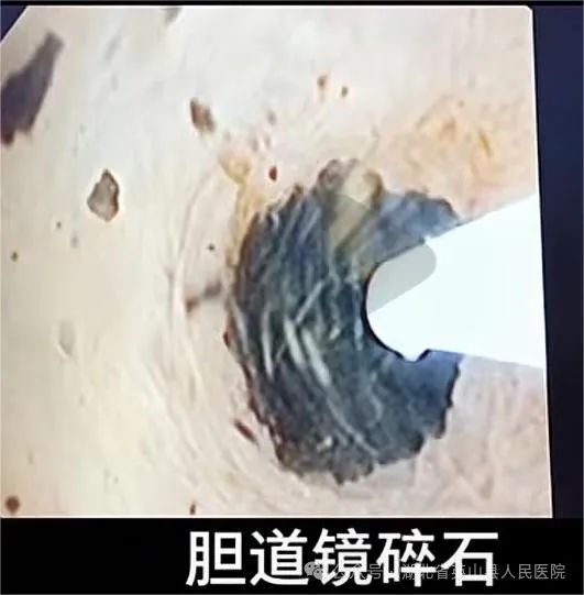 午夜精品白在线观看