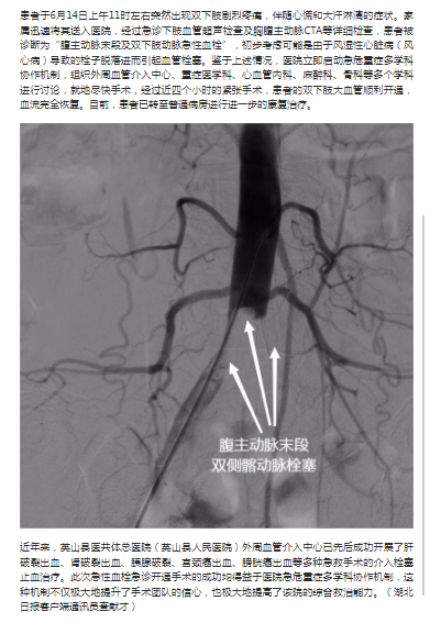 午夜精品白在线观看