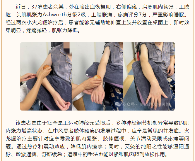 午夜精品白在线观看
