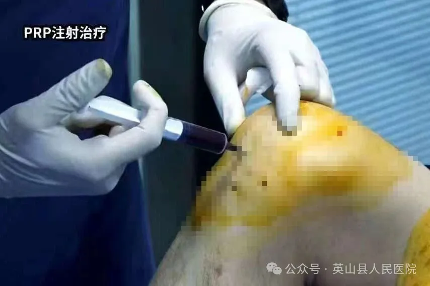 午夜精品白在线观看
